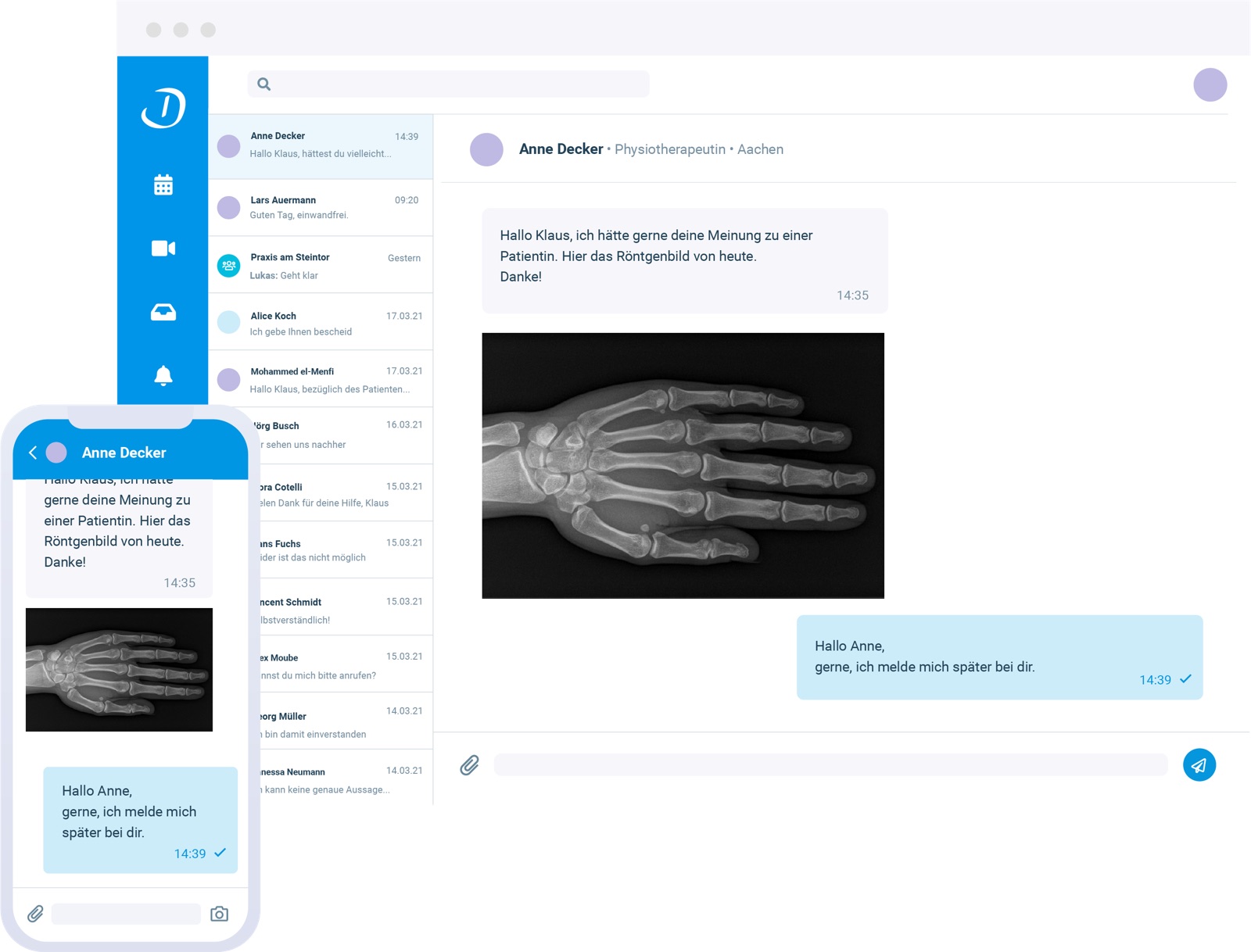 Doctolib Team on desktop and mobile: a physiotherapist shares a hand X-ray with a colleague and asks for their opinion
